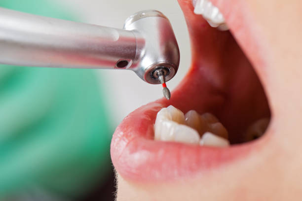 Best Emergency Orthodontic Repairs in Mount Vernon, GA